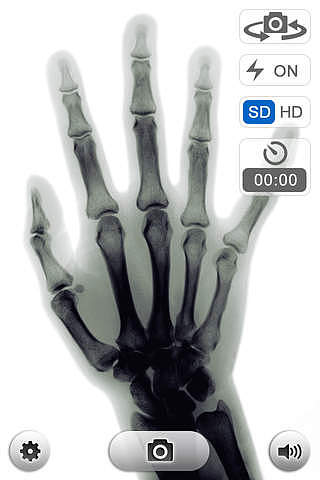 X-Ray (X-Ray Caméra) pour mac