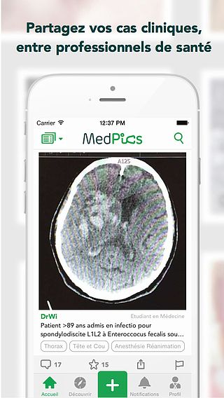 MedPics - le Partage de Photos Médicales entre Professionnels de pour mac